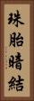 珠胎暗結 Vertical Portrait