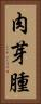 肉芽腫 Vertical Portrait