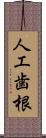 人工歯根 Scroll