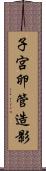 子宮卵管造影 Scroll