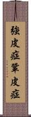 強皮症 Scroll