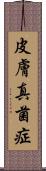 皮膚真菌症 Scroll