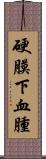 硬膜下血腫 Scroll