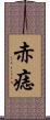 赤痣 Scroll
