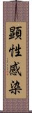 顕性感染 Scroll