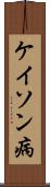 ケイソン病 Scroll