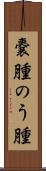 嚢腫 Scroll