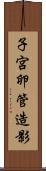 子宮卵管造影 Scroll