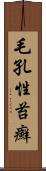 毛孔性苔癬 Scroll