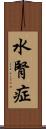 水腎症 Scroll
