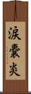 涙嚢炎 Scroll
