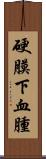 硬膜下血腫 Scroll