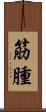 筋腫 Scroll