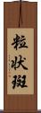 粒状斑 Scroll