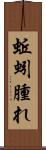 蚯蚓腫れ Scroll