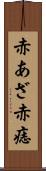 赤あざ Scroll