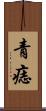 青痣 Scroll