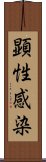 顕性感染 Scroll