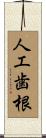 人工歯根 Scroll