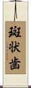 斑状歯 Scroll