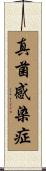 真菌感染症 Scroll