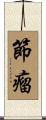 節瘤 Scroll