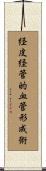 経皮経管的血管形成術 Scroll