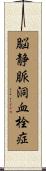 脳静脈洞血栓症 Scroll