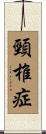 頸椎症 Scroll