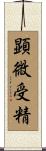 顕微受精 Scroll