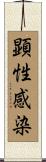 顕性感染 Scroll