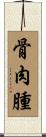 骨肉腫 Scroll