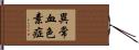 異常血色素症 Hand Scroll