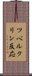 ツベルクリン反応 Scroll