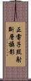 正電子照射斷層攝影 Scroll