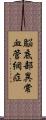 脳底部異常血管網症 Scroll