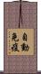 自動免疫 Scroll