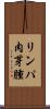 リンパ肉芽腫 Scroll