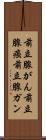 前立腺がん Scroll