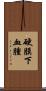 硬膜下血腫 Scroll