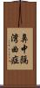 鼻中隔湾曲症 Scroll