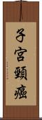 子宮頸癌 Scroll