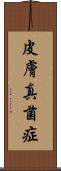 皮膚真菌症 Scroll