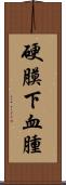 硬膜下血腫 Scroll