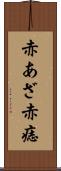 赤あざ Scroll