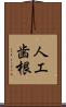 人工歯根 Scroll