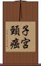 子宮頸癌 Scroll