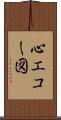 心エコー図 Scroll