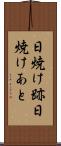 日焼け跡 Scroll