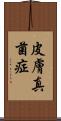 皮膚真菌症 Scroll